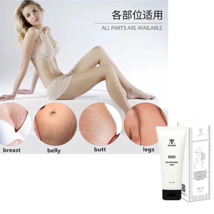 Hot Selling Best Stretch Marks Removal Cream and Stretch Mark Machine for Body Care - Image 6